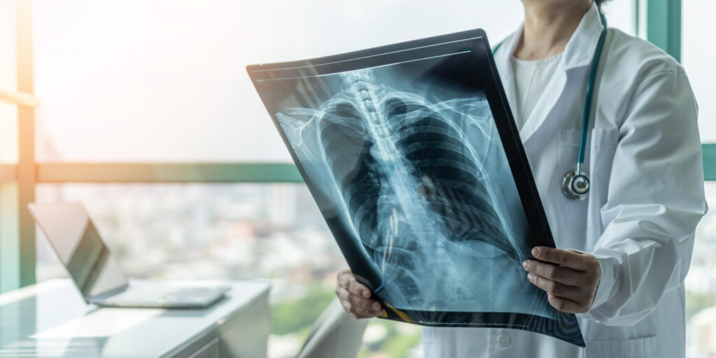 Doctor diagnosing patient's health with radiological chest x-ray film