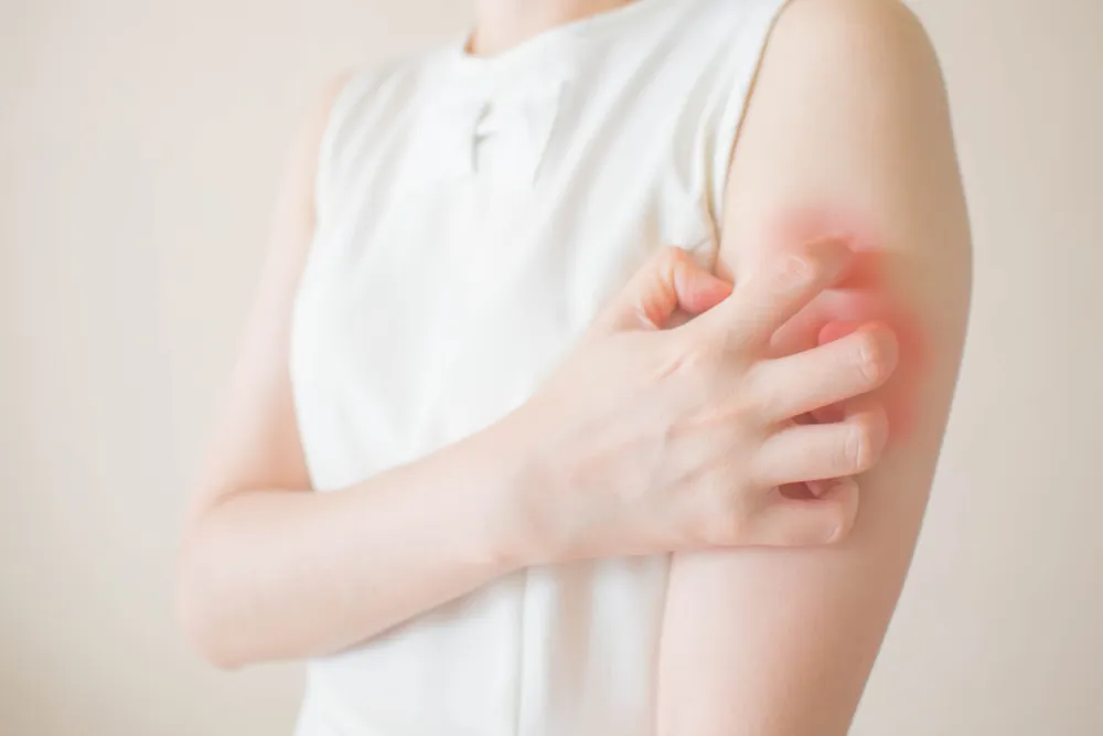 Young woman scratching arm from having itching on white background