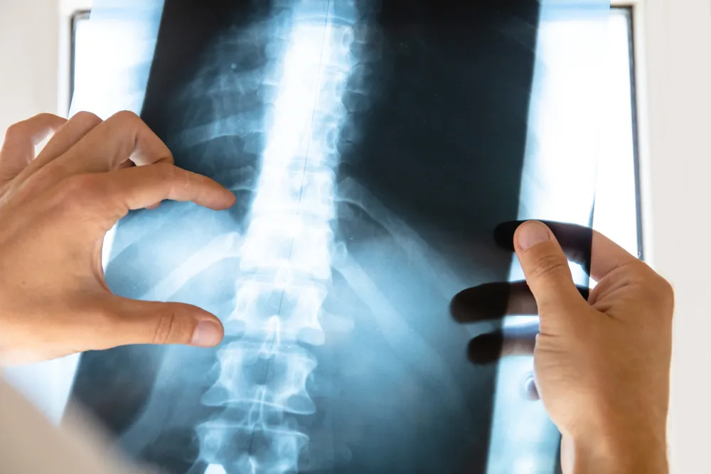 doctor examines x-ray picture of human spine