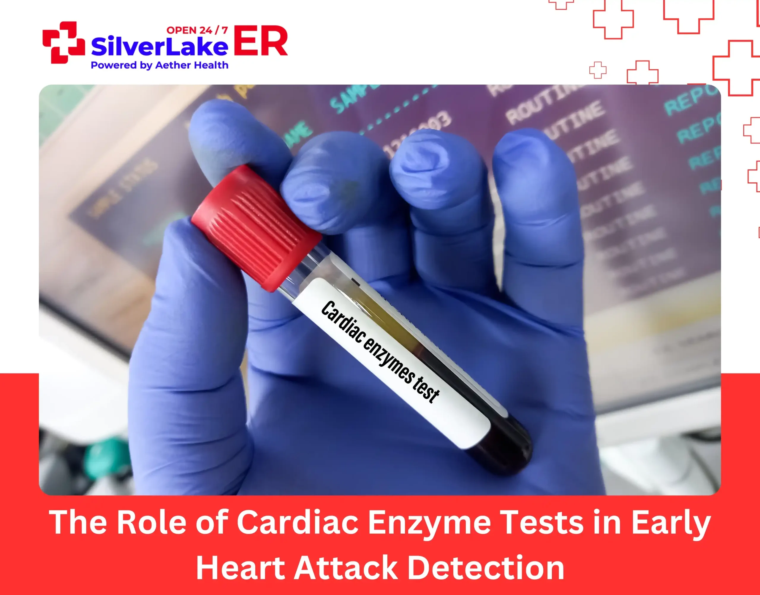 The Role of Cardiac Enzyme Tests in Early Heart Attack Detection