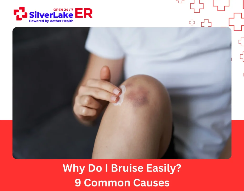 Why Do I Bruise Easily 9 Common Causes