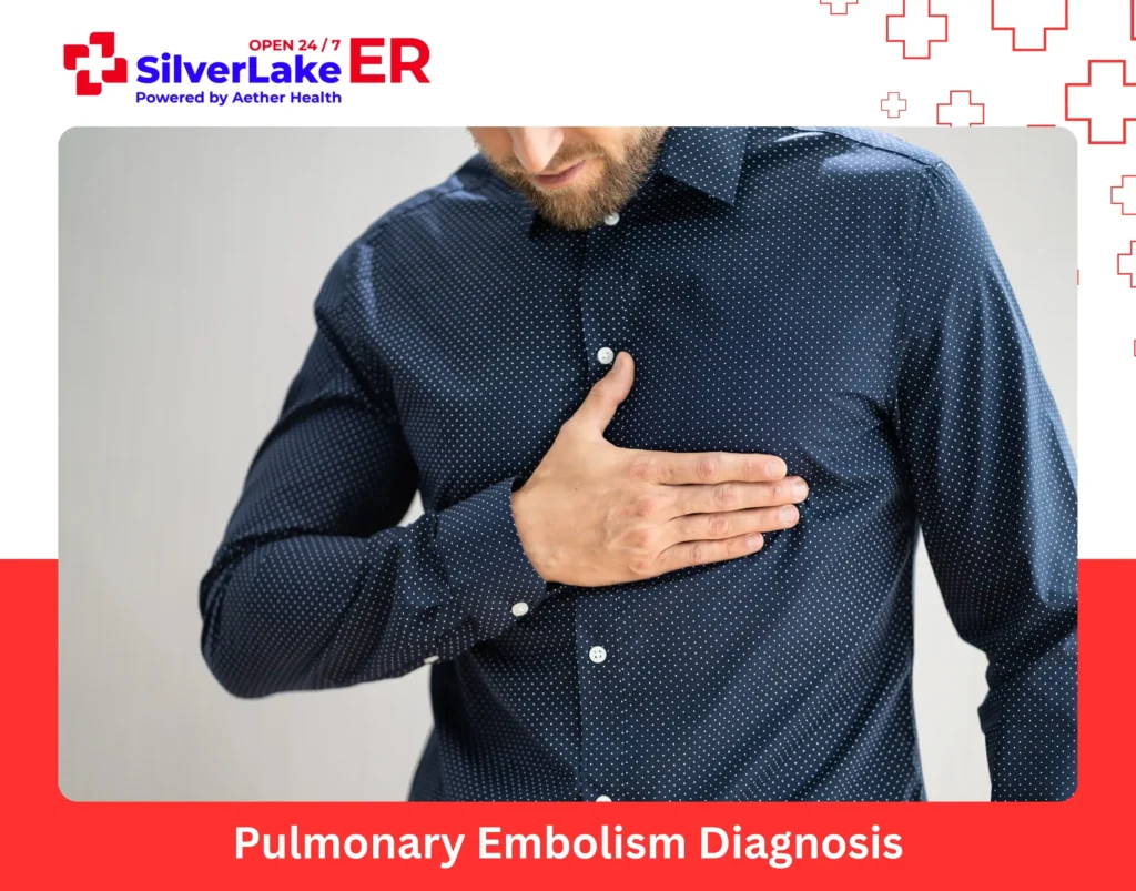 Pulmonary Embolism Diagnosis