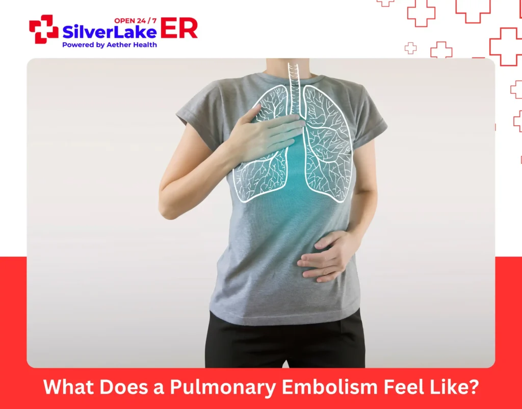 What Does a Pulmonary Embolism Feel Like