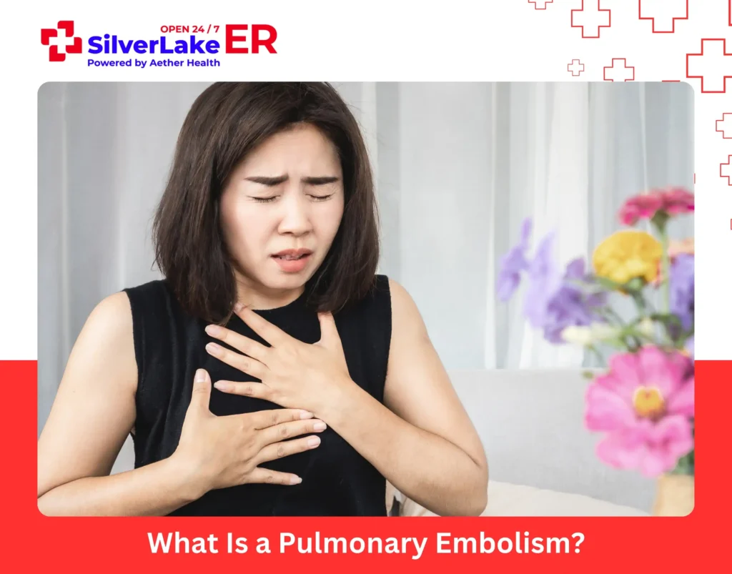 What Is a Pulmonary Embolism