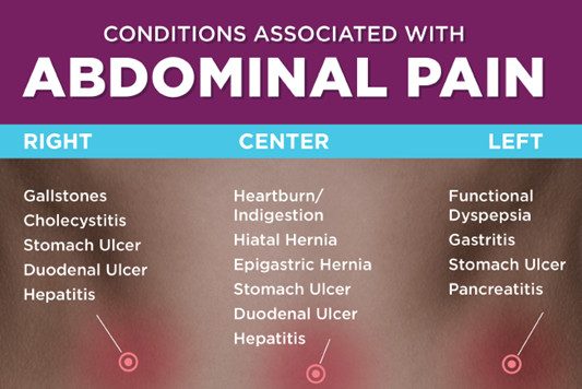 Abdominal Pain Chart