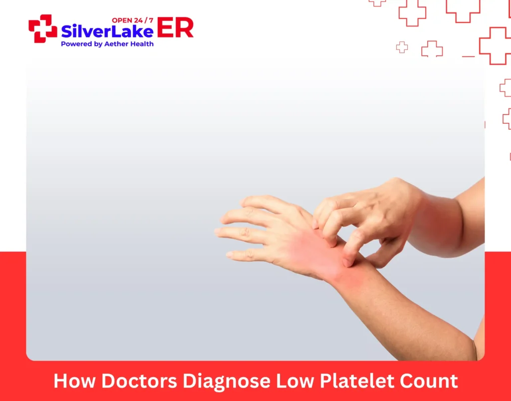 How Doctors Diagnose Low Platelet Count