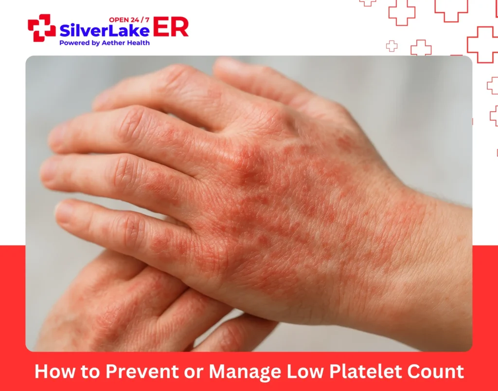 How to Prevent or Manage Low Platelet Count