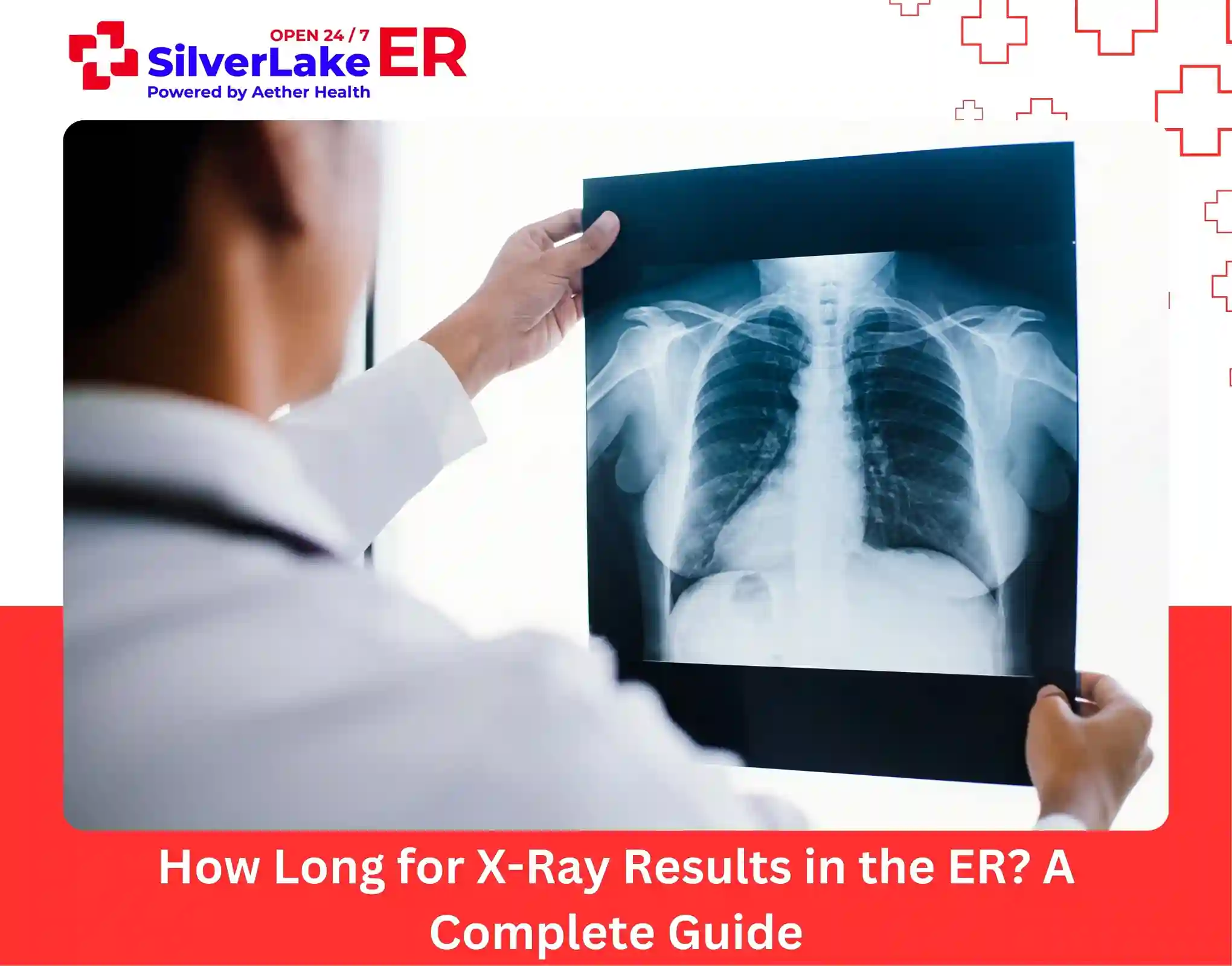 How Long for X-Ray Results in the ER A Complete Guide