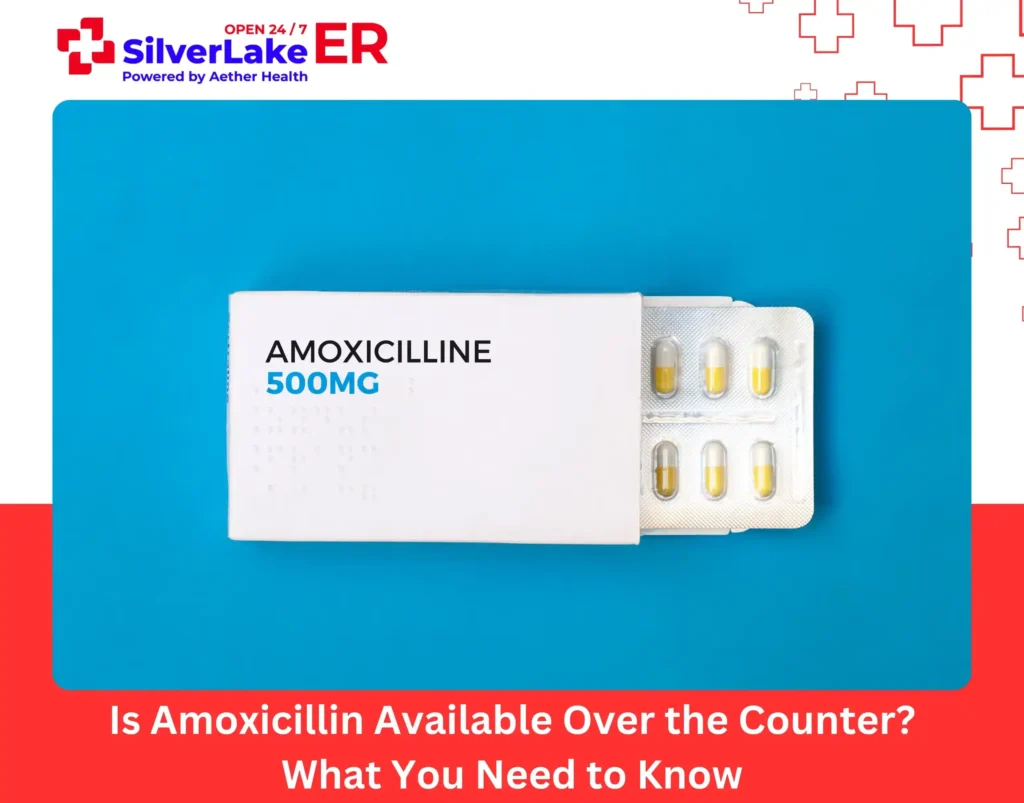 Is Amoxicillin Available Over the Counter What You Need to Know