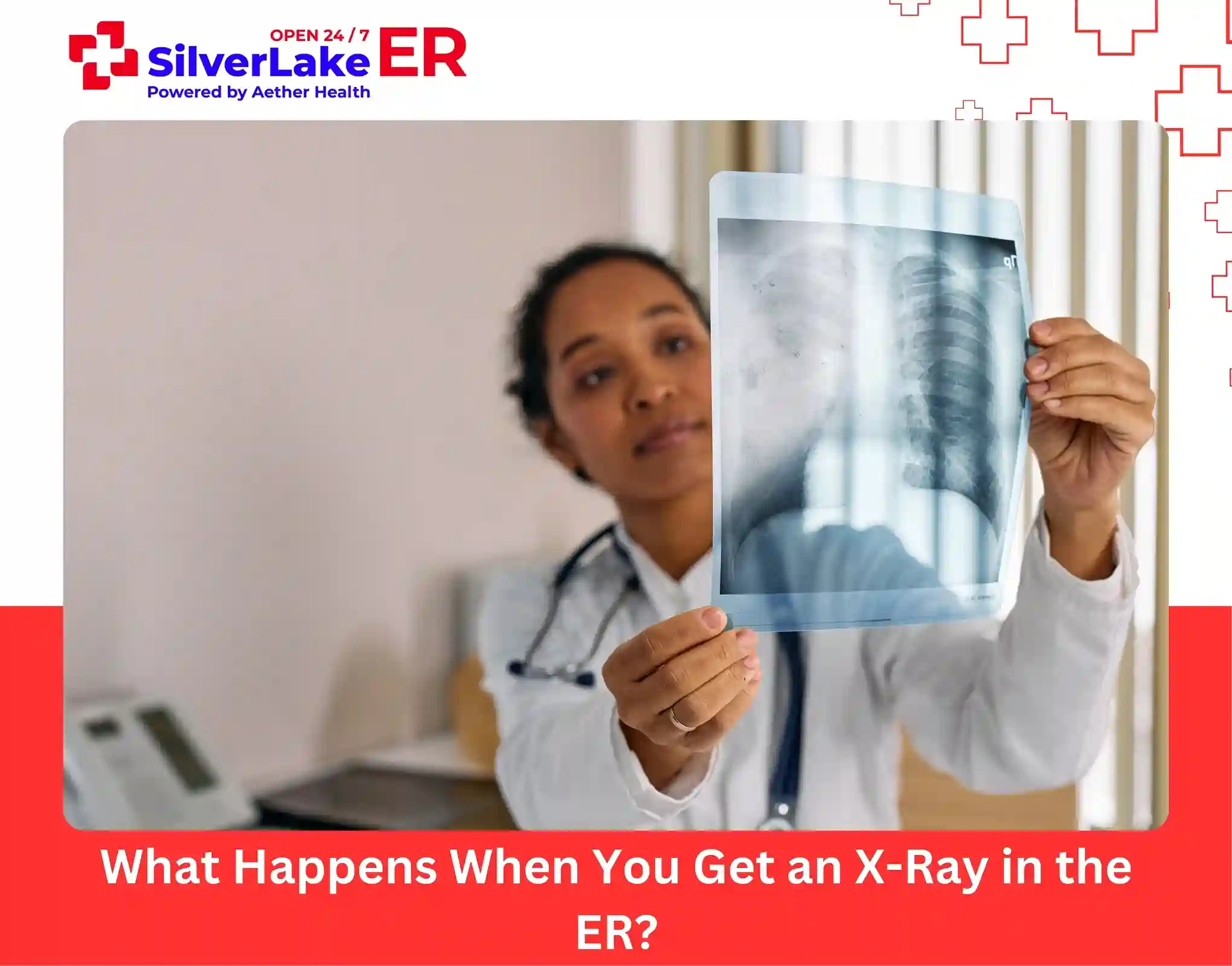 What Happens When You Get an X-Ray in the ER