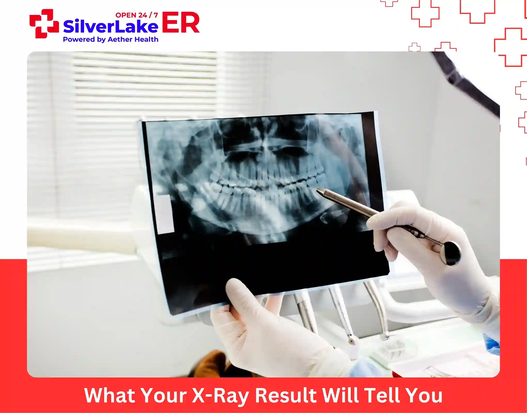 What Your X-Ray Result Will Tell You