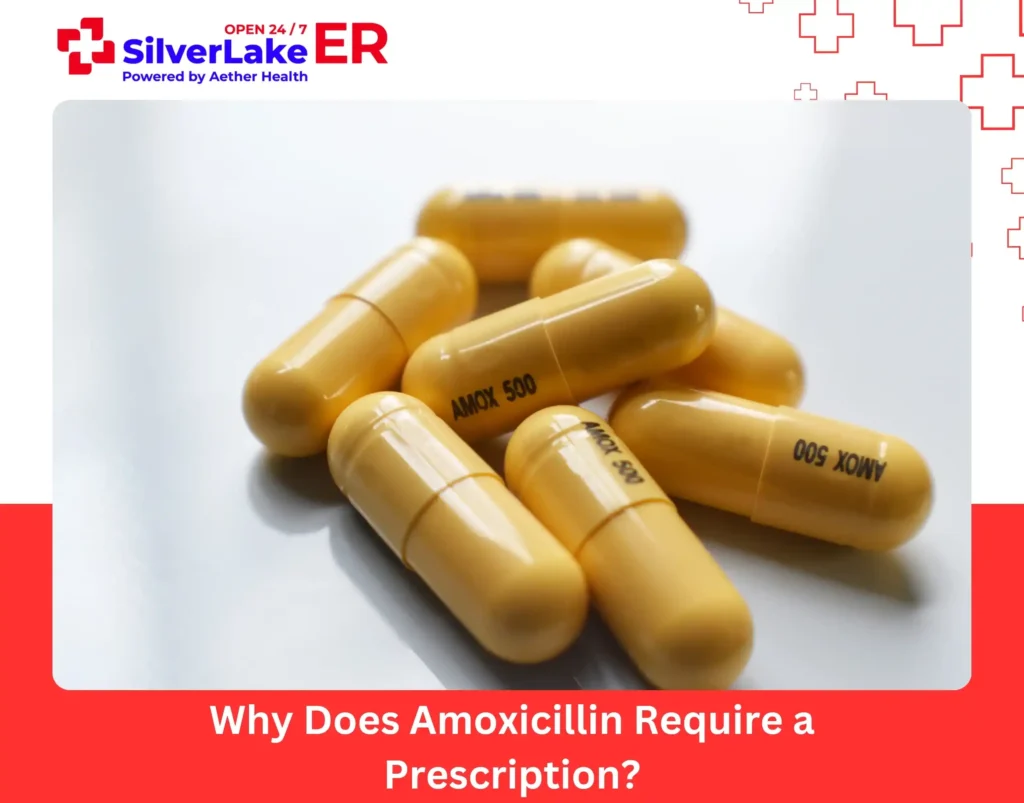Why Does Amoxicillin Require a Prescription