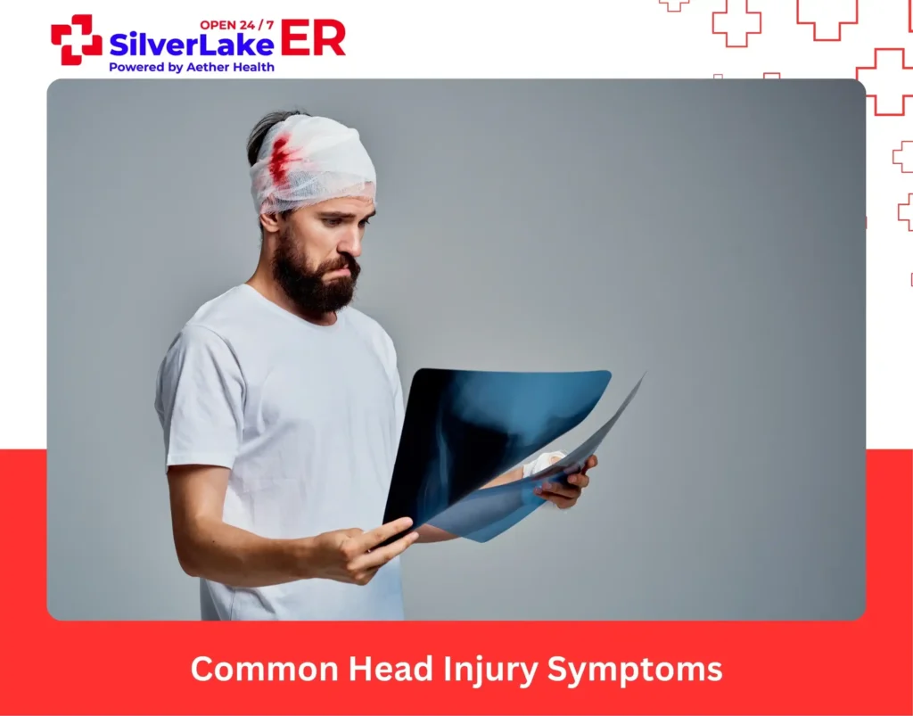 Common Head Injury Symptoms