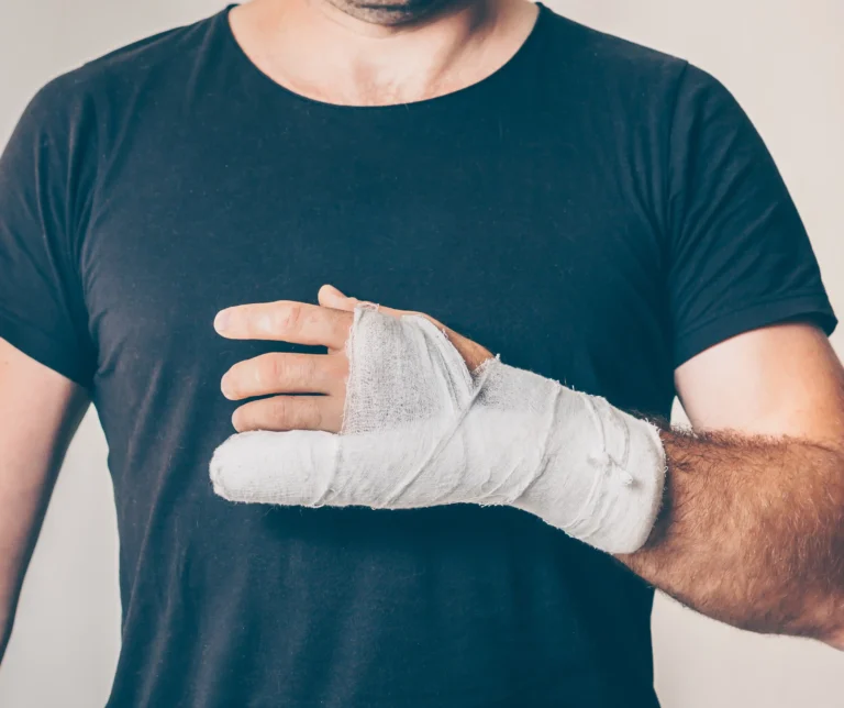 Fracture Stabilization