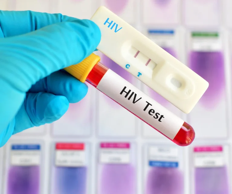 HIV