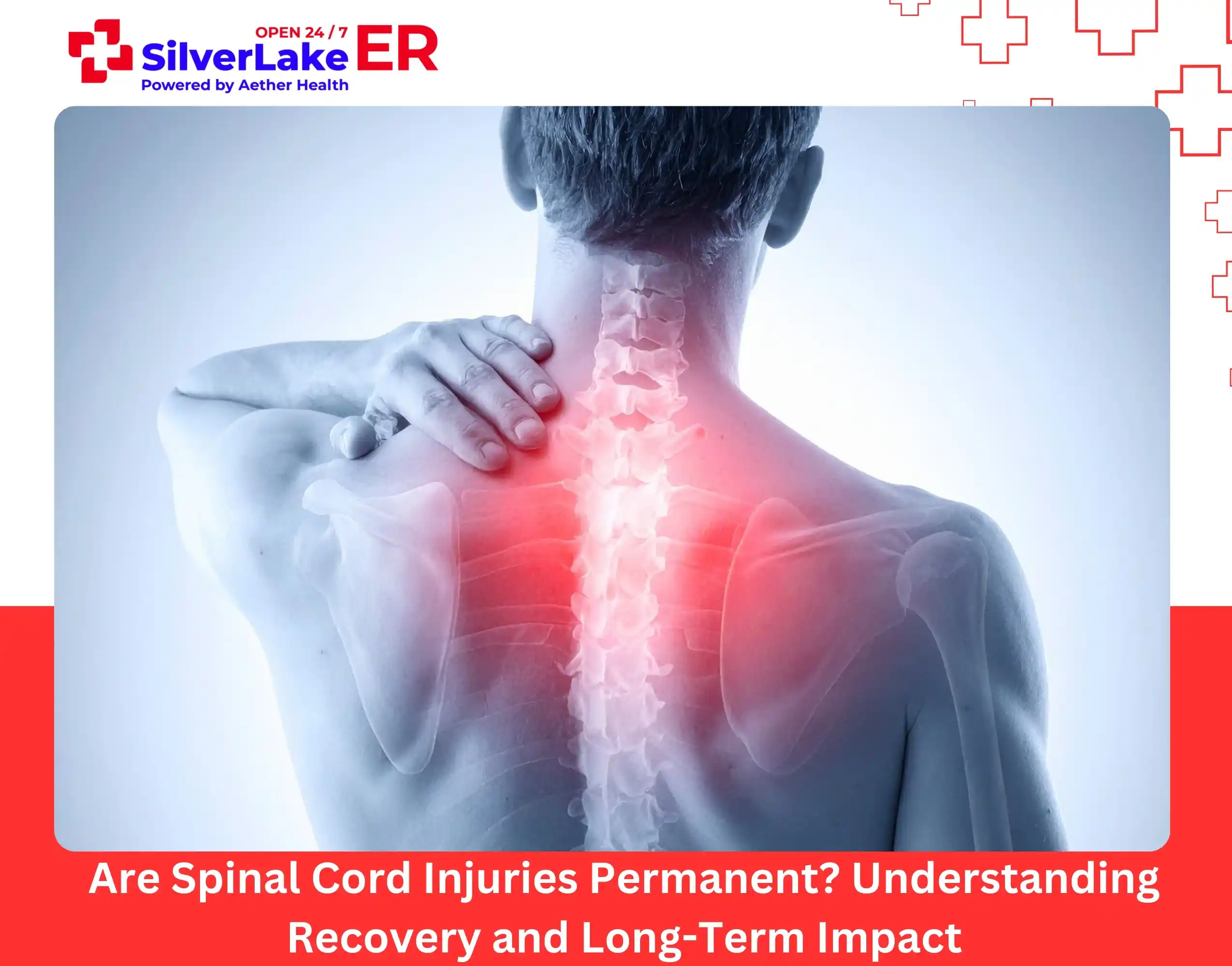 Are Spinal Cord Injuries Permanent Understanding Recovery and Long-Term Impact