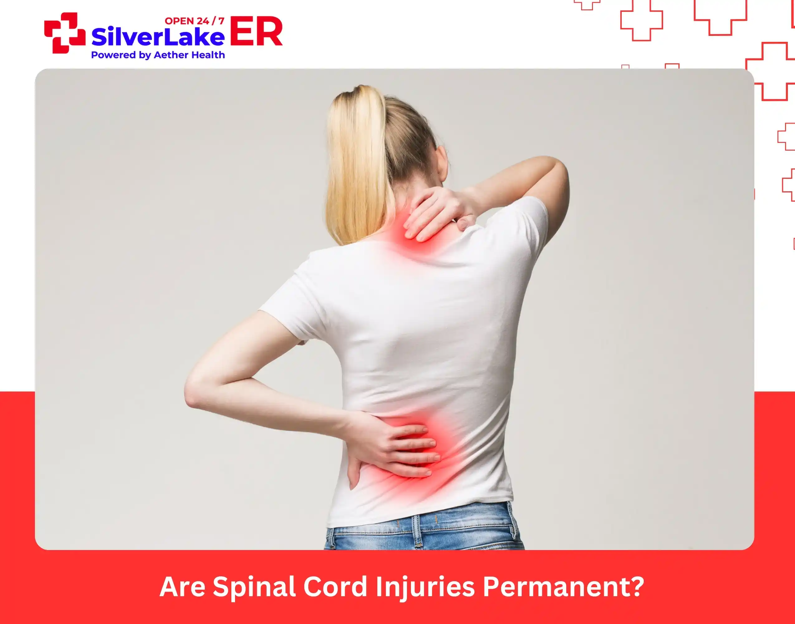 Are Spinal Cord Injuries Permanent