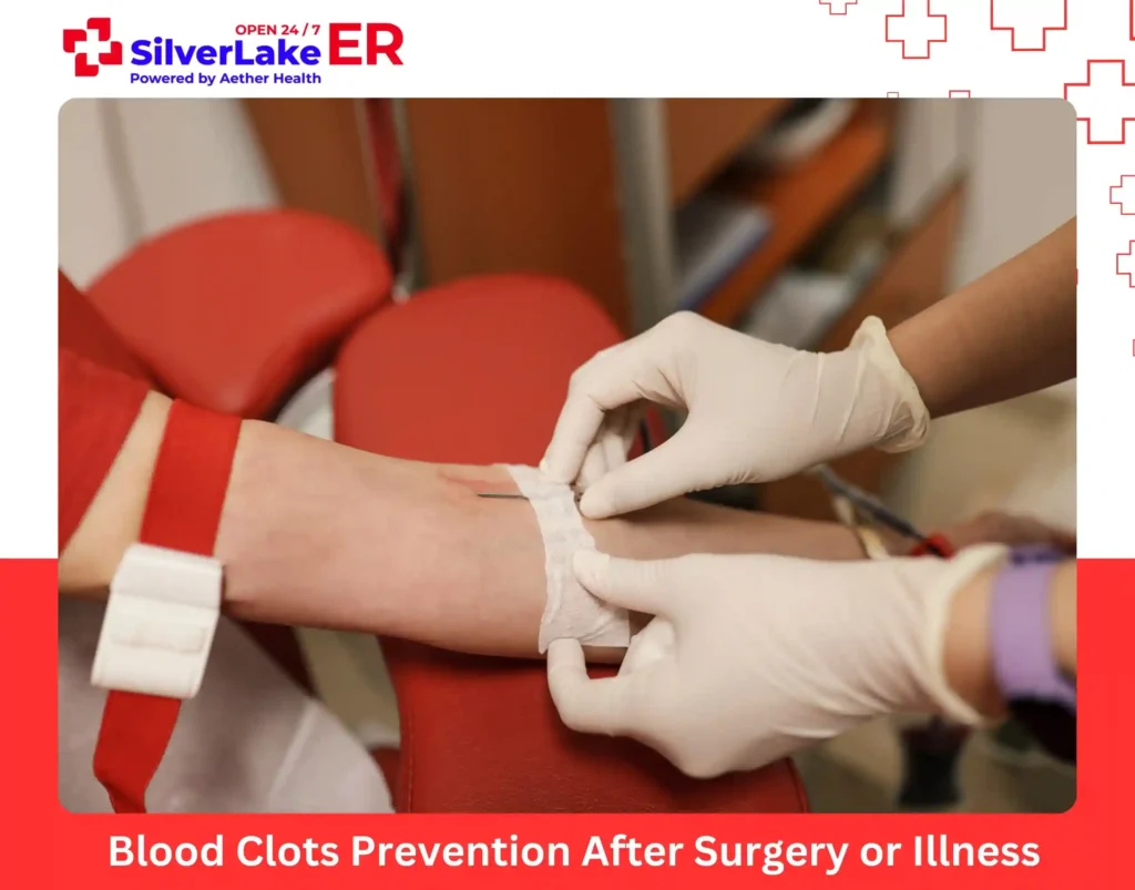 Blood Clots Prevention After Surgery or Illness