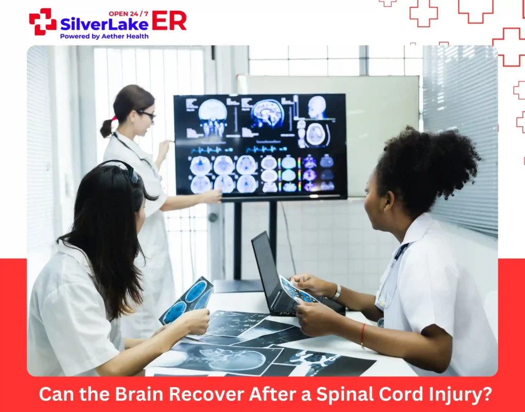 Can the Brain Recover After a Spinal Cord Injury