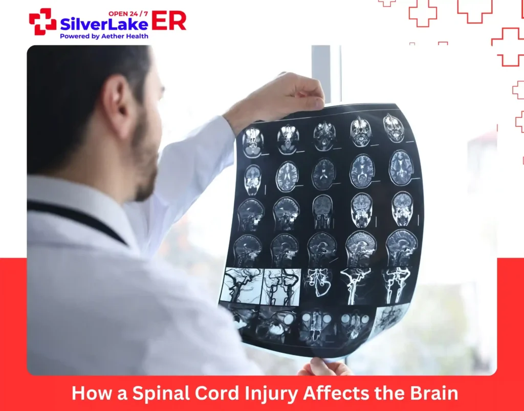 How a Spinal Cord Injury Affects the Brain