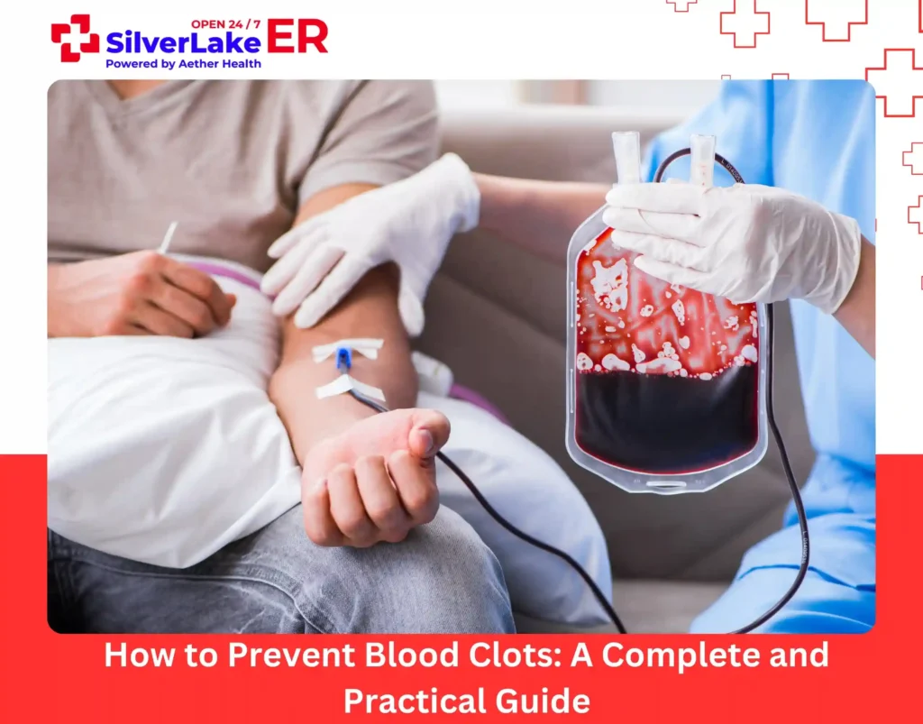 How to Prevent Blood Clots