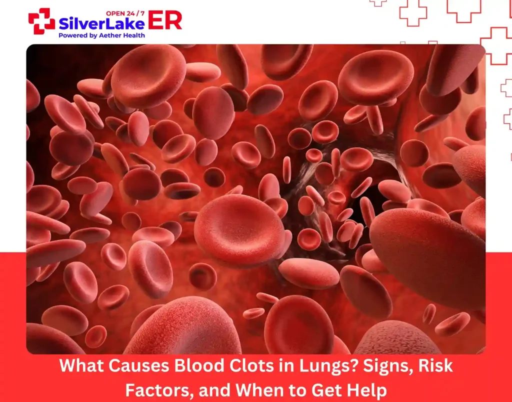 What Causes Blood Clots in Lungs Signs, Risk Factors, and When to Get Help