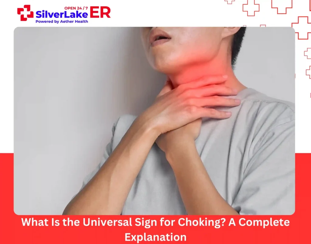What Is the Universal Sign for Choking A Complete Explanation