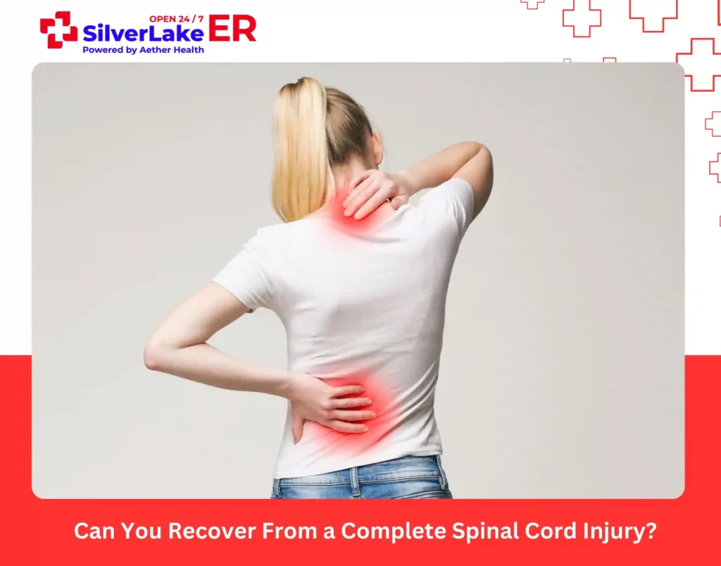 Can You Recover From a Complete Spinal Cord Injury