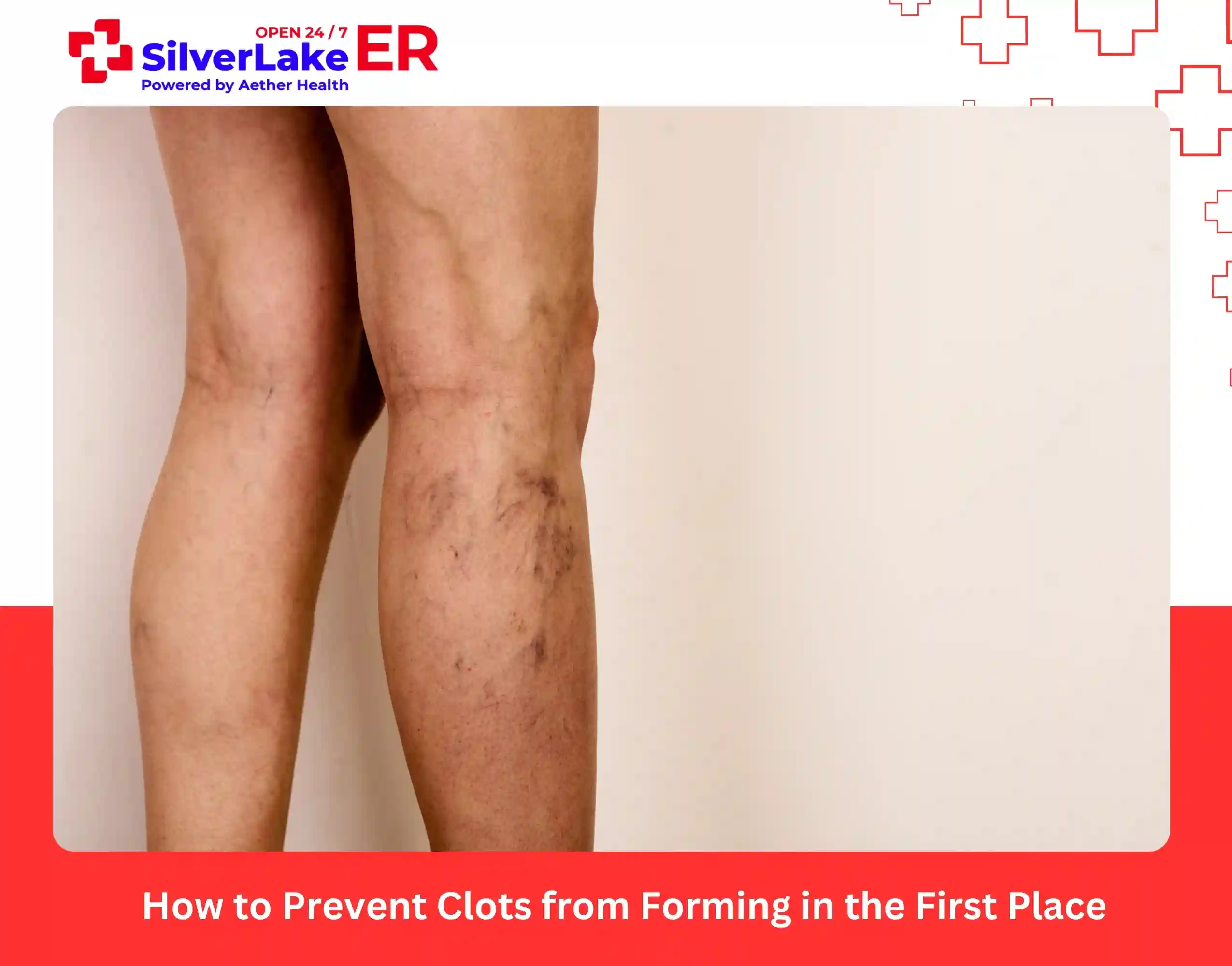 How to Prevent Clots from Forming in the First Place