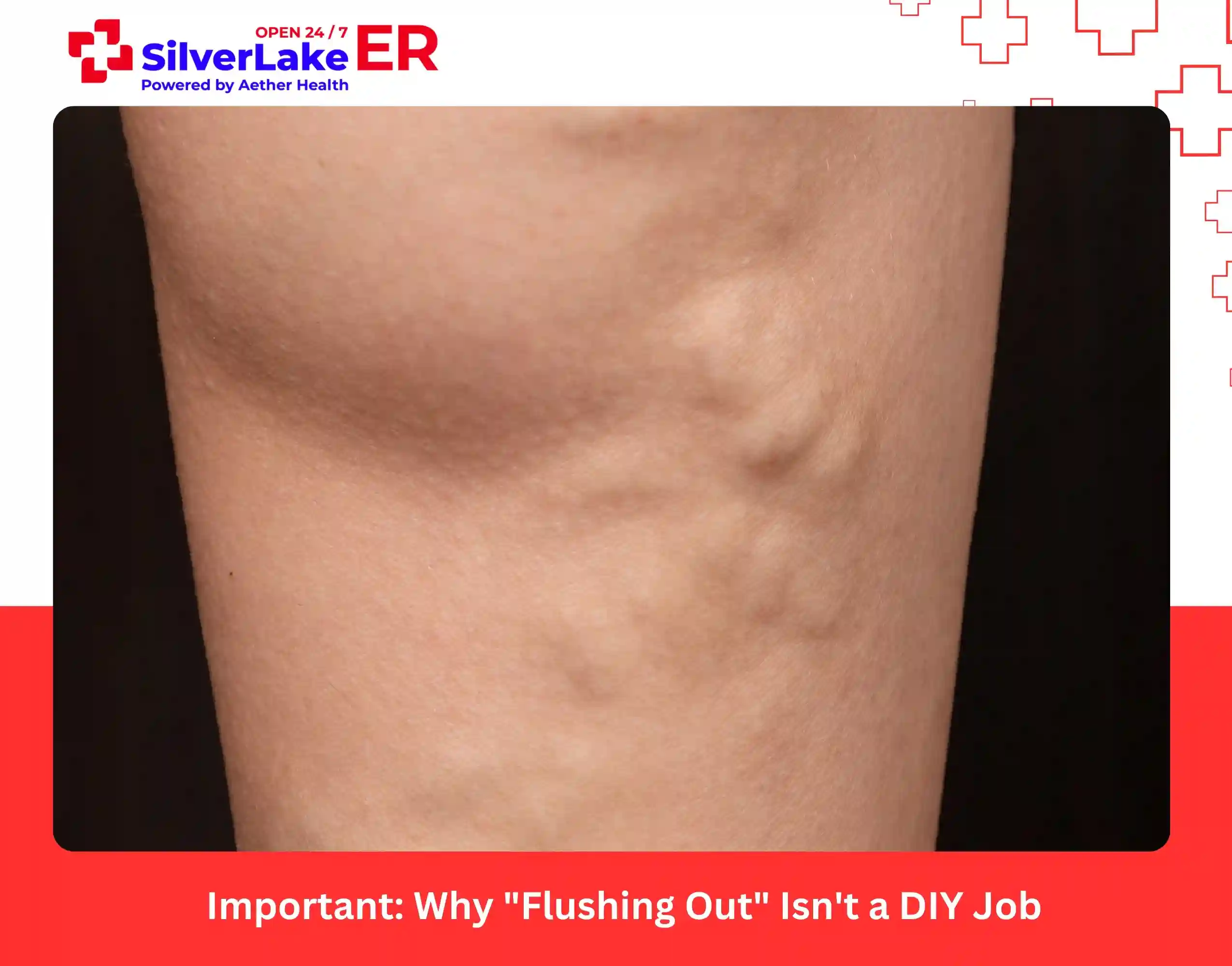 Important Why Flushing Out Isn't a DIY Job