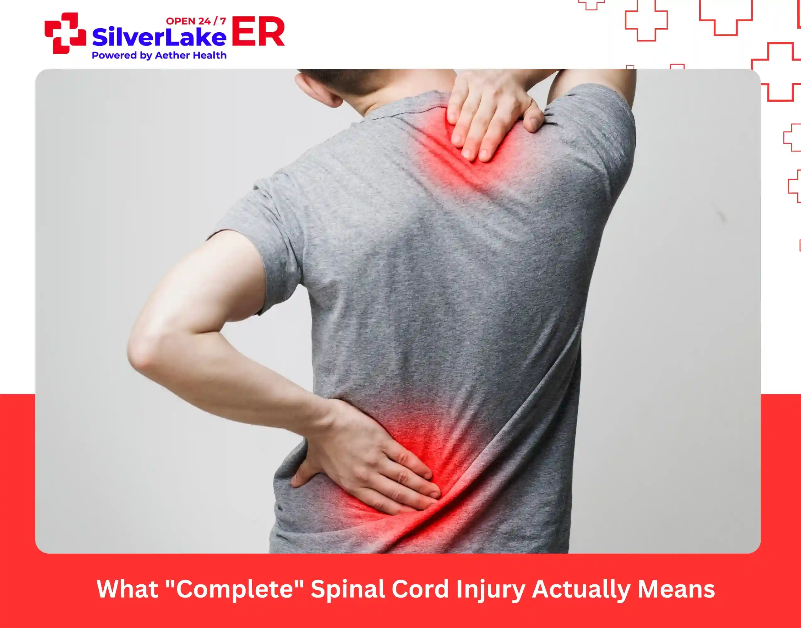 What Complete Spinal Cord Injury Actually Means