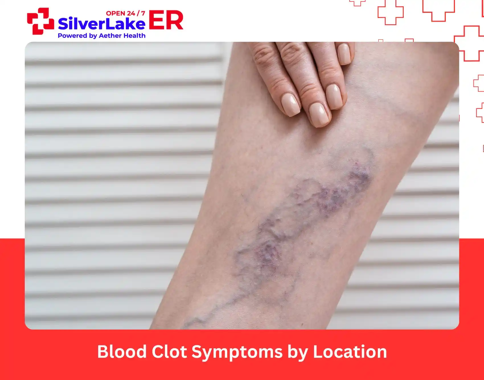 Blood Clot Symptoms by Location