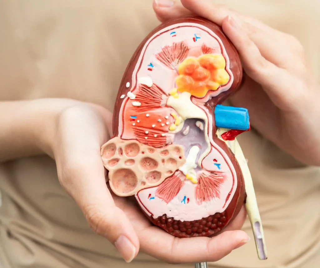 Kidney
