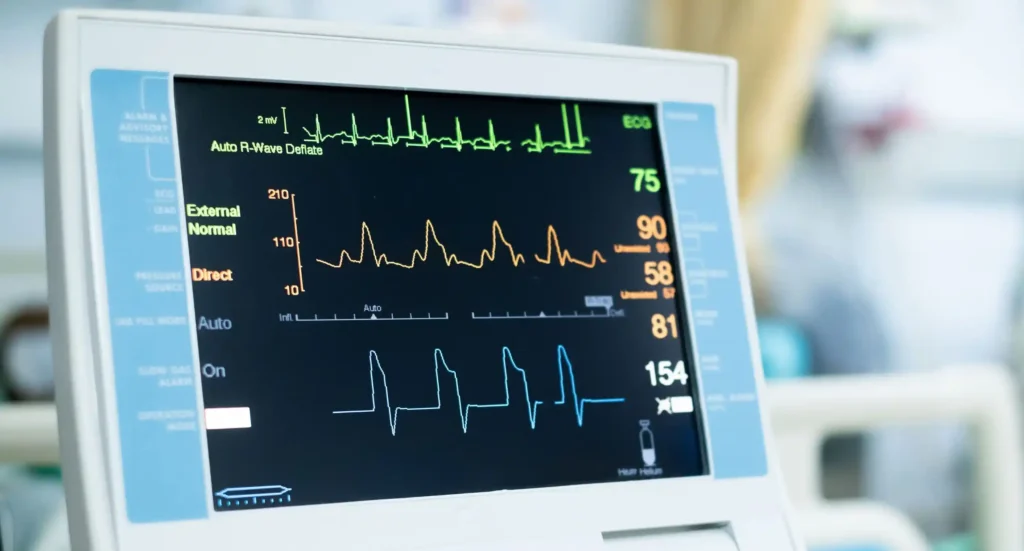EKG