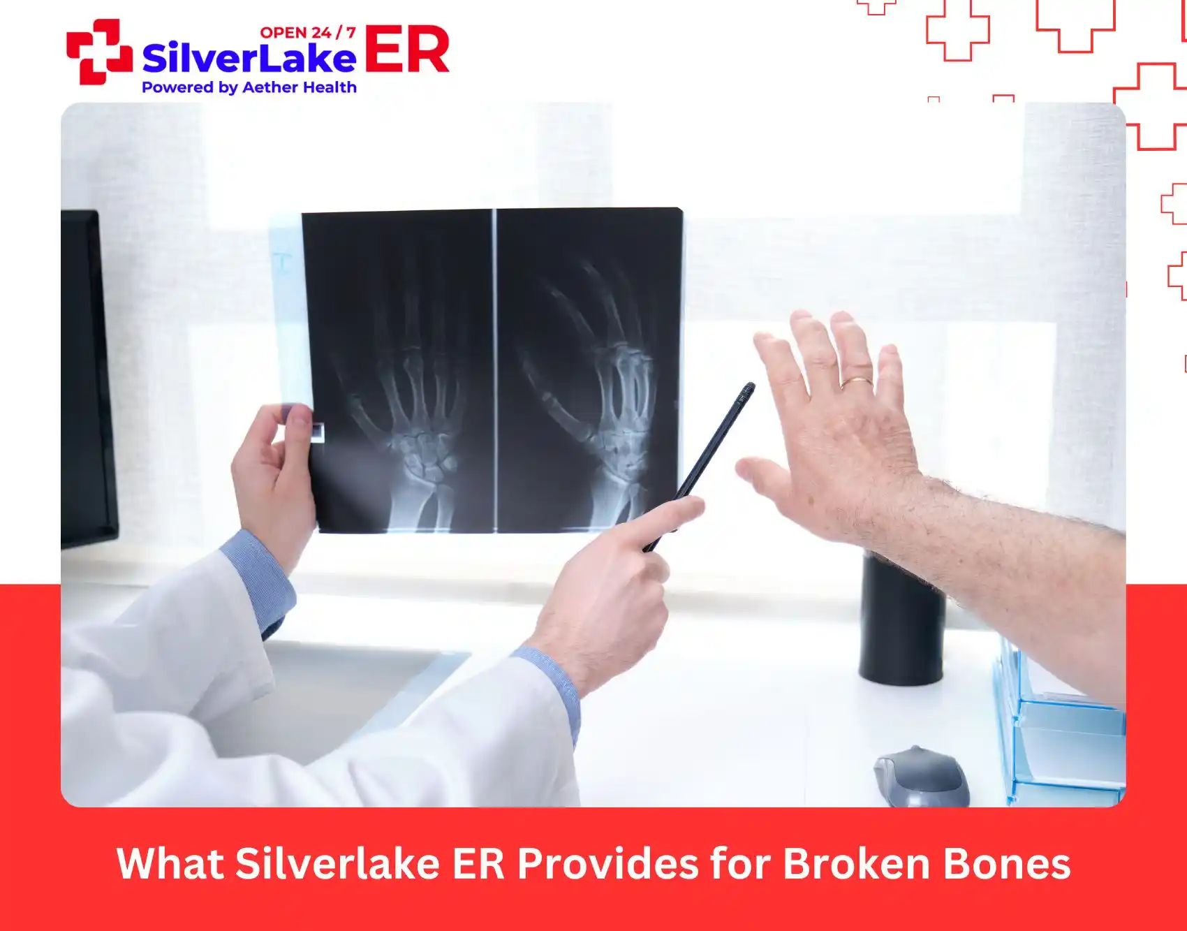 What Silverlake ER Provides for Broken Bones