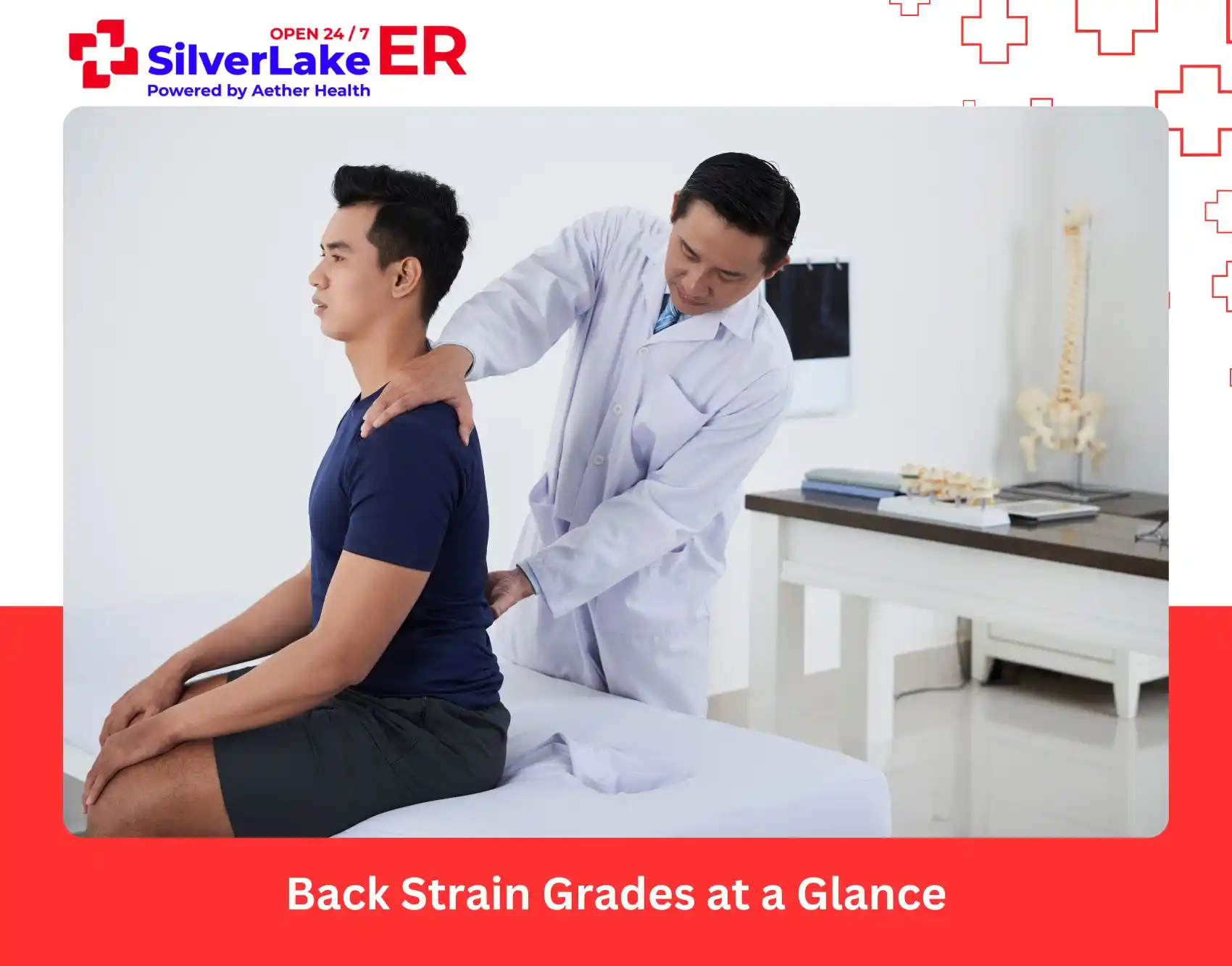 Back Strain Grades at a Glance