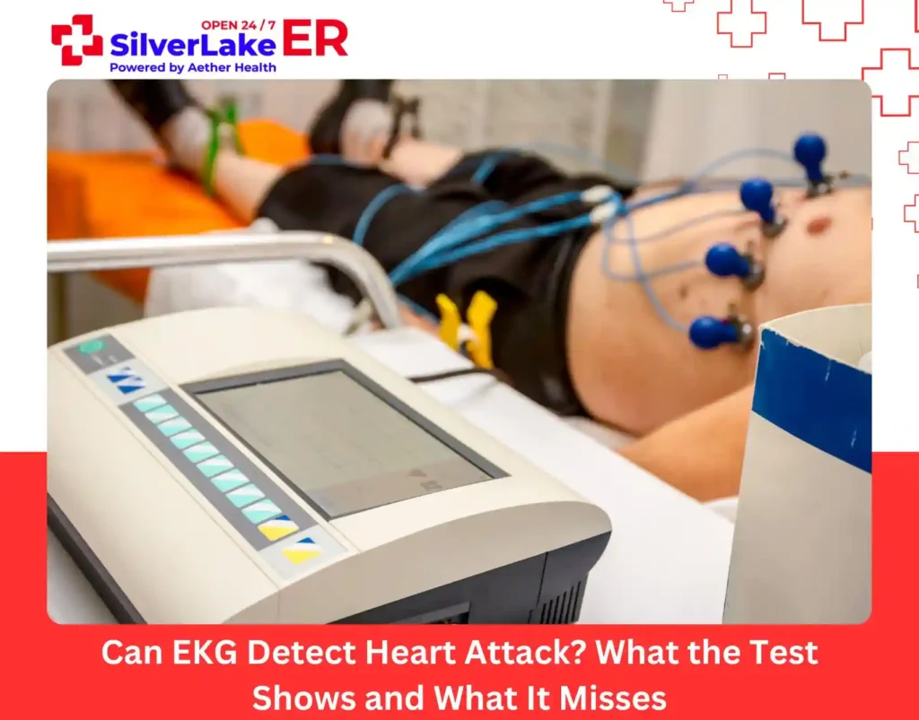 Can EKG Detect Heart Attack What the Test Shows and What It Misses