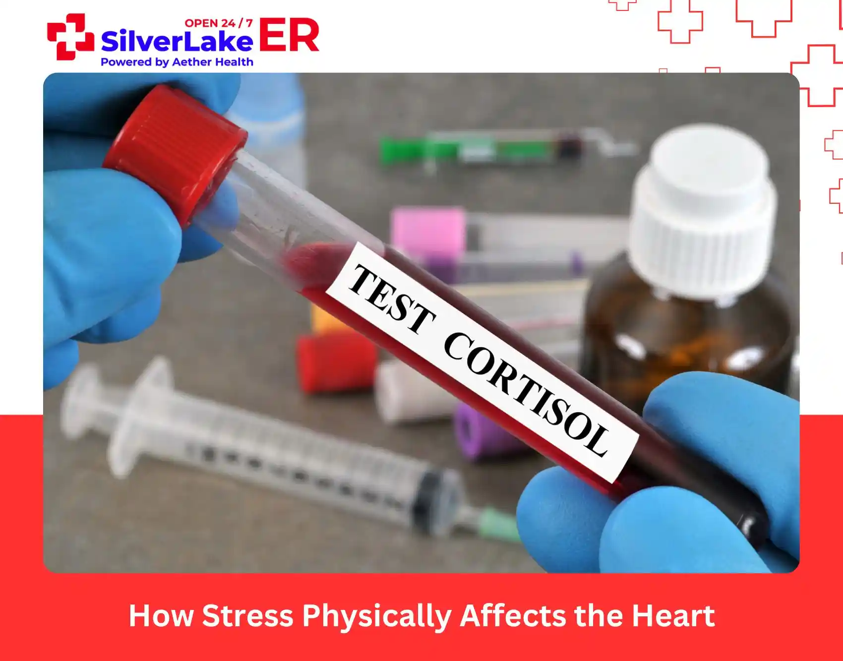 How Stress Physically Affects the Heart