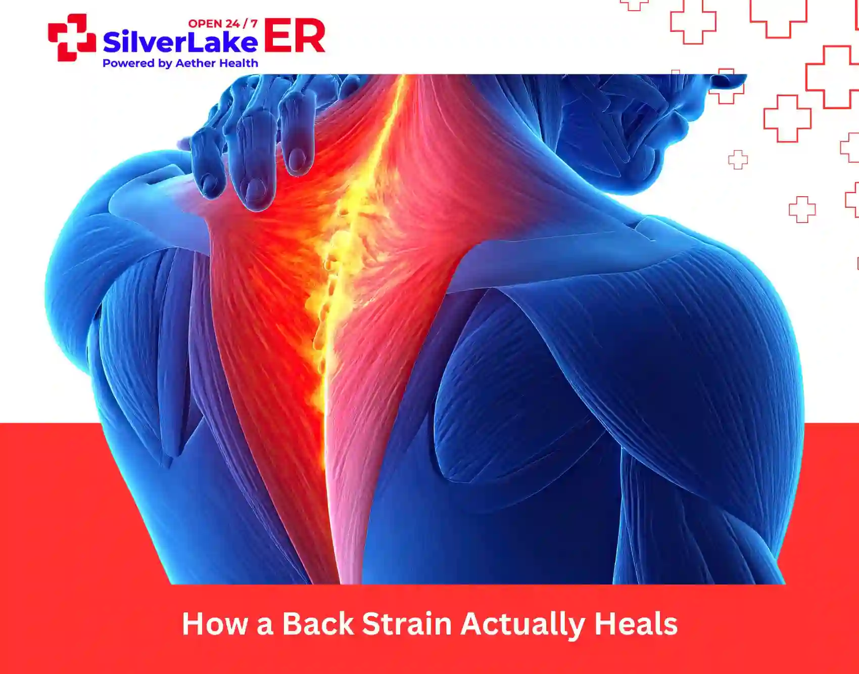How a Back Strain Actually Heals