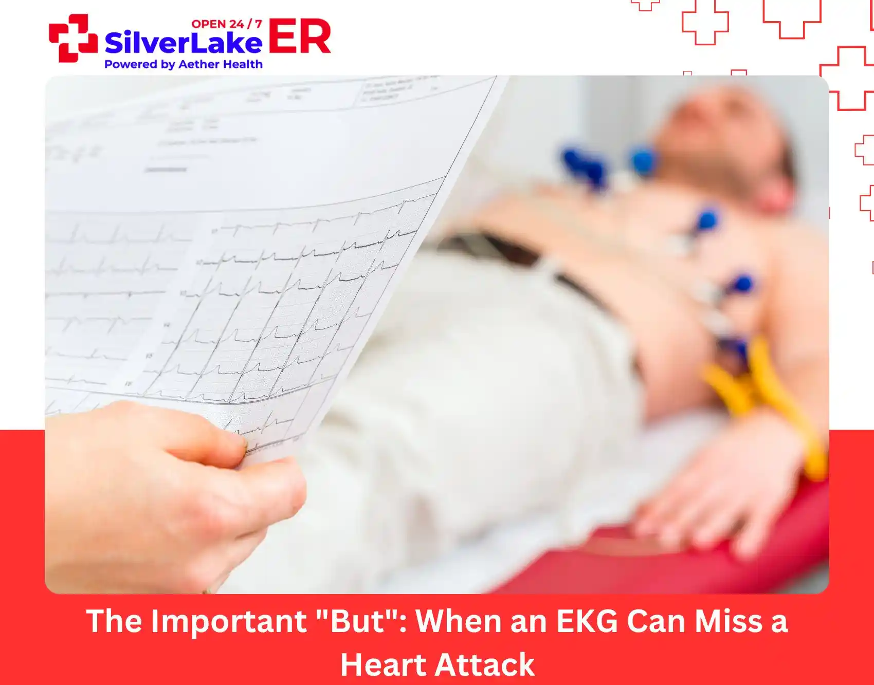 The Important But When an EKG Can Miss a Heart Attack